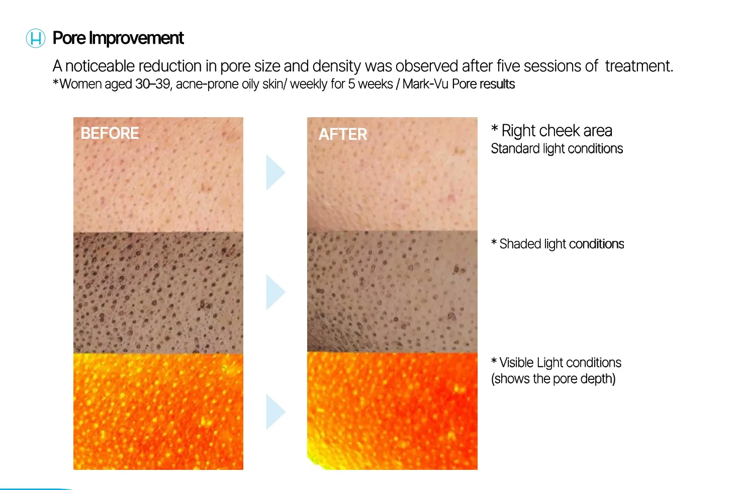 Healfusion Pro before and after example