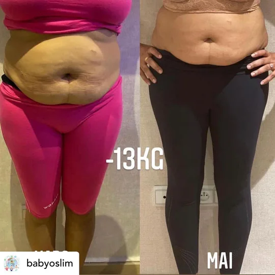 Wonder Axon before and after example